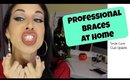 Professional Braces At Home | Perfect Straight Teeth | Smile Care Club Update