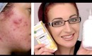 MY NEW ACNE ROUTINE! Morning & Night + Review (Acne.Org, Garnier Dark Spot Corrector, Exposed)