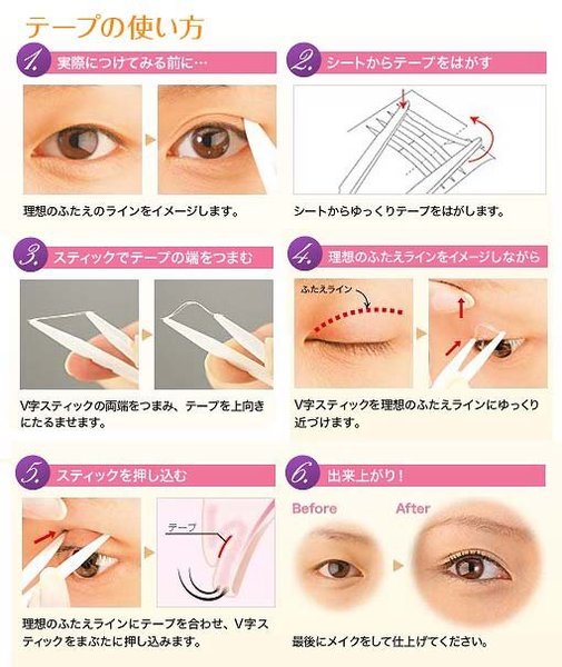 asian-eyelid-morphologies-are-categorized-into-six-types-a-single