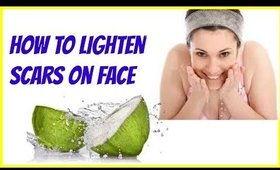 DIY Beauty Tips & Tricks-How to lighten scars on face