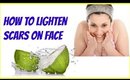 DIY Beauty Tips & Tricks-How to lighten scars on face