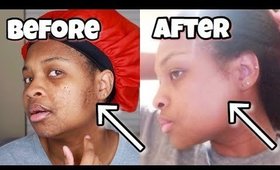 I USED A TURMERIC MASK FOR 1 WEEK| BEFORE & AFTER  (HYPER-PIGMENTATION AND DARK SPOTS)
