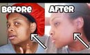 I USED A TURMERIC MASK FOR 1 WEEK| BEFORE & AFTER  (HYPER-PIGMENTATION AND DARK SPOTS)