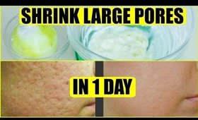 How To Get Rid Of Large Pores In 1 Day | SuperPrincessjo