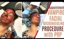The WHOLE PROCESS of a MICRONEEDLING VAMPIRE FACIAL START to FINISH, Vampire Facial for Acne Scars