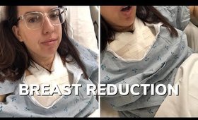 BREAST REDUCTION EXPERIENCE: 1 WEEK POST OP, INSURANCE, PREPARATION, 32J TO 32C