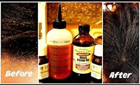 My Secret Weapon For Getting Rid Of Dandruff - Castor Oil, Tea Tree Oil & Peppermint Oil Mixture