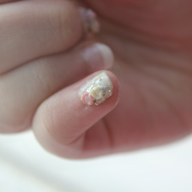 Nail Looks