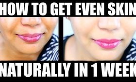 How To Get Even Skin Tone in 1 Week Naturally | SuperPrincessjo