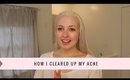 How I Cleared Up My Acne | My Tips, Products, Routine