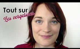 Les vergetures: origines, prévention et traitement