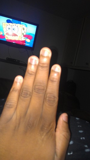 my nails are short can someone tell me what to do so they can grow longer