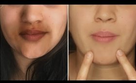 How to Remove Dark spots, Dark Brown Patches, Dark lips, Acne Scars, Hyper pigmentation | Makemeup89