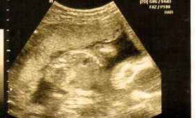I am having a baby! Is it a GIRL or a BOY?