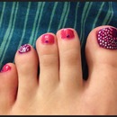 Purple toe nails 