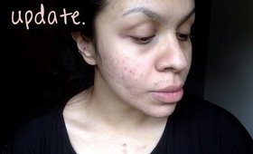 Impromptu Organic Skincare Update | TheRaviOsahn