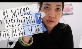 HOW I CURED MY ACNE SCARS | WHAT IS RADIOFREQUENCY MICRONEEDLING |Thefabzilla