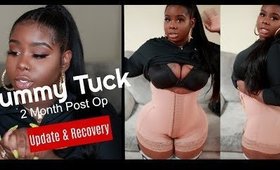 ♡ 2 Months Post Op Recovery & Updates !