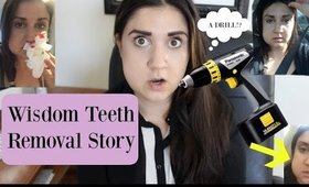 My Wisdom Teeth Surgery Experience Sucked! | STORYTIME