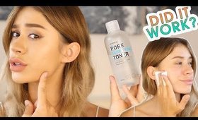 SKINMISO PORE PURIFYING TONER REVIEW | On Sensitive Acne Prone Dry Skin