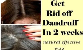 Get rid off dandruff in 2 weeks-Best & Effective Natural way