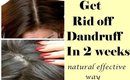 Get rid off dandruff in 2 weeks-Best & Effective Natural way