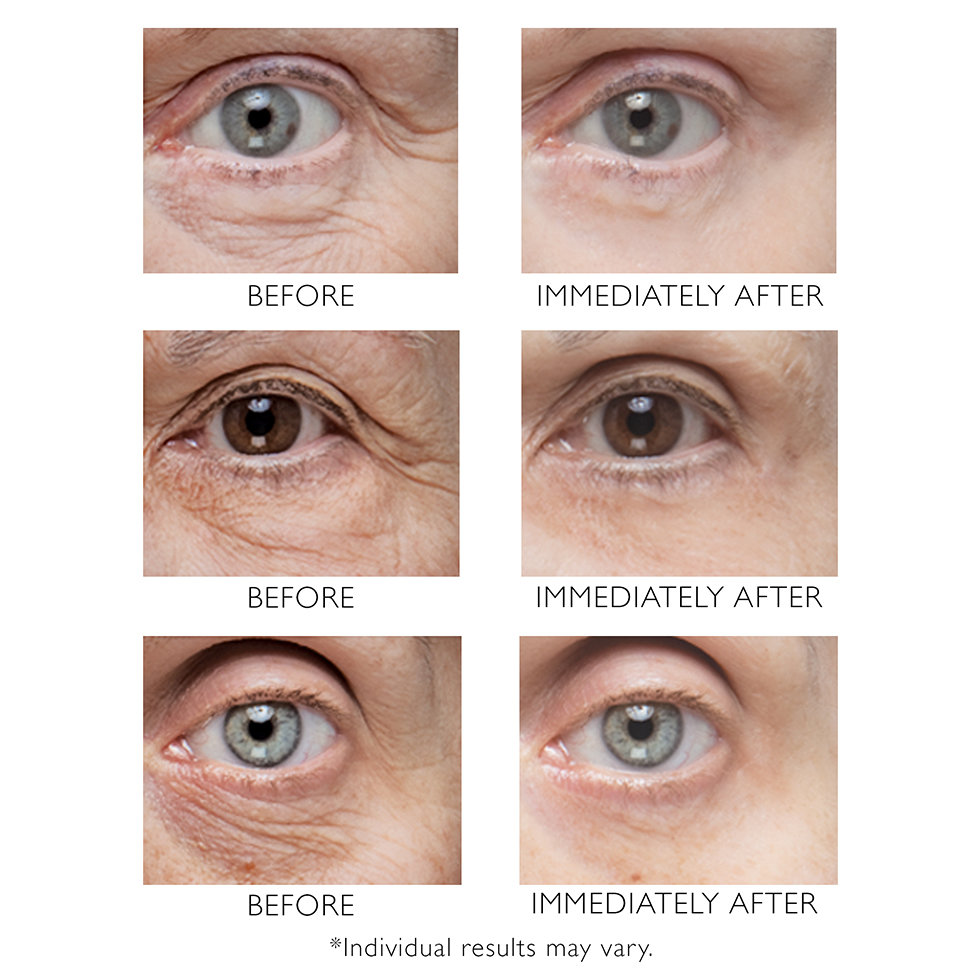 Peter Thomas Roth Instant FIRMx Eye Before & After image