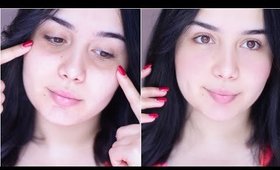 طريقة التخلص سريعا من الهالات السوداء طبيعيا | Bye Bye Dark Circles