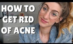 HOW TO GET RID OF ACNE