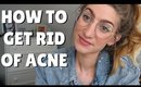 HOW TO GET RID OF ACNE