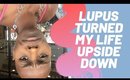 lupus turned my life upside down
