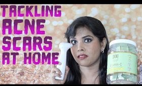 Skincare Routine For Acne Scars & Hyperpigmentation: BEFORE & AFTER RESULTS