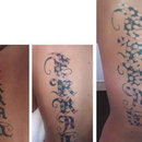 Tattoo Removal in Adelaide with Complete Satisfaction