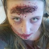 Zombie Head Wound