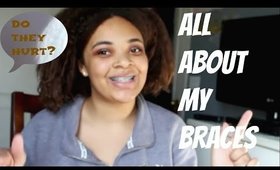 ALL ABOUT MY BRACES | BRACES  Q & A