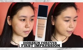 BEST FOUNDATION EVER? Diorskin Forever Foundation on hyperpigmentation skin