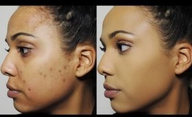 How I Cover Dark Spots & Acne Scars | Ashley Bond Beauty
