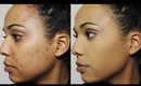 How I Cover Dark Spots & Acne Scars | Ashley Bond Beauty