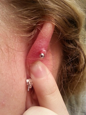 a week old pierced conch with dry blood. : r/PiercingAdvice