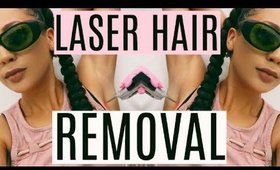 1 Year After Laser Hair Removal | Was It Worth It?