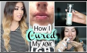 Back to School: How I Cured My Acne