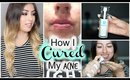Back to School: How I Cured My Acne