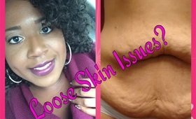 "Obese People" Yes You Will Have Loose Skin|  #weightloss #looseskin