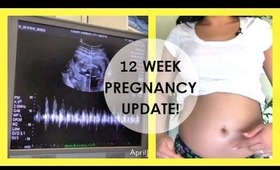 12 Week Pregnancy Vlog: Symptoms, Cravings, Pain & Constipation