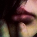 Bruised Lip