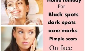 Homeremedy to remove black spot,dark spots,acne marks,pimple scars