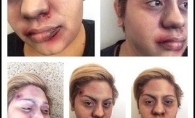 Halloween Makeup Tutorials: beat up/dead