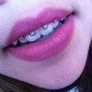 Lipstick with braces