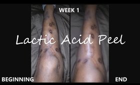 Lactic Acid:Fading Surgery Scars | Week 1 | Demo + Result Pics