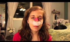 ♡ Nose Job Vlog: Part 1 ♡